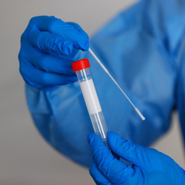 Doping kontrola