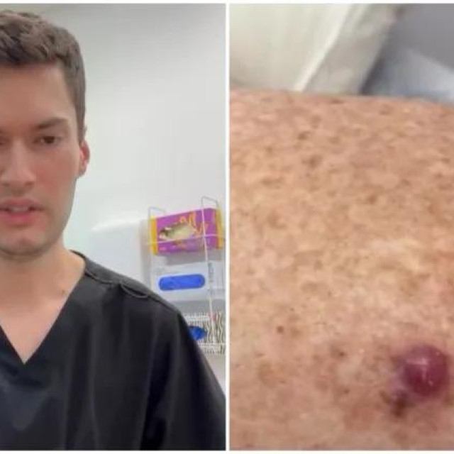 Dr. John O‘Bryen, specijalist iz klinike Body Scan Skin Cancer Clinic u Australiji