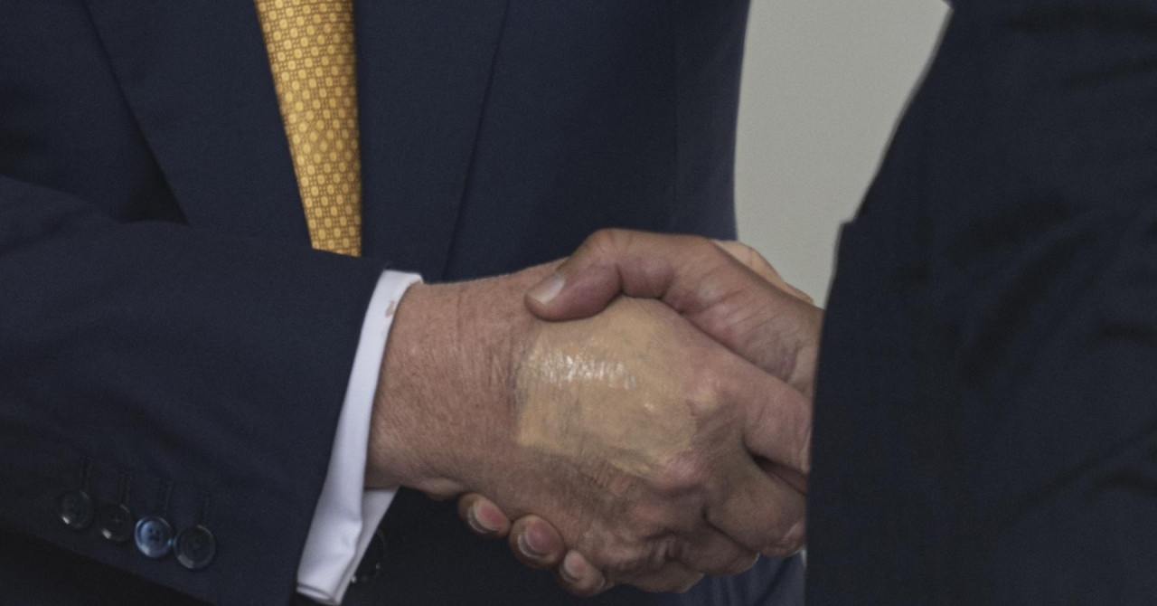 Trump je pokušao sve sakriti šminkom, ali nije uspio. Glasine se šire, a liječnici misle da znaju o čemu je riječ