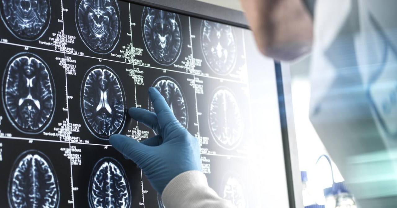 Preiskava možganov v srednji starosti kot napovednik življenjske dobe