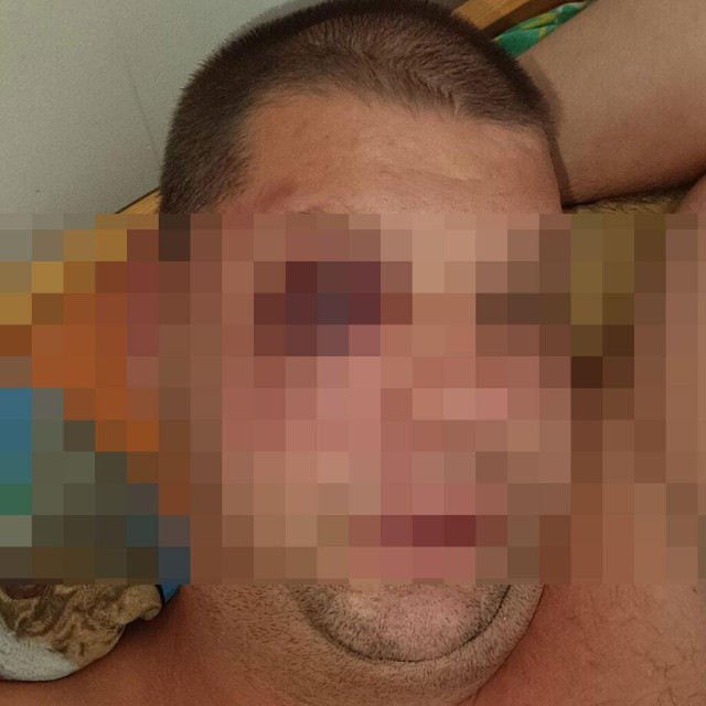 Pretučeni muškarac