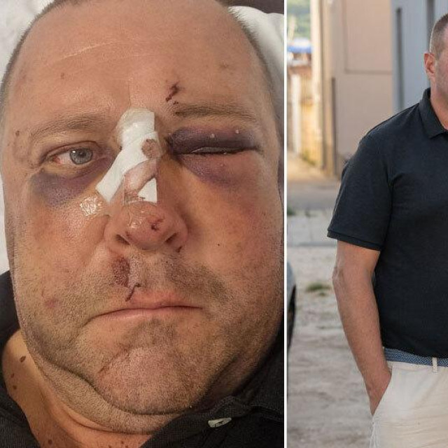 Riječanka Natali Tonejec i njezin suprug Klemen Janez Tonejec preselili su se na otok u potrazi za mirnim životom, no umjesto toga doživjeli su brutalni napad