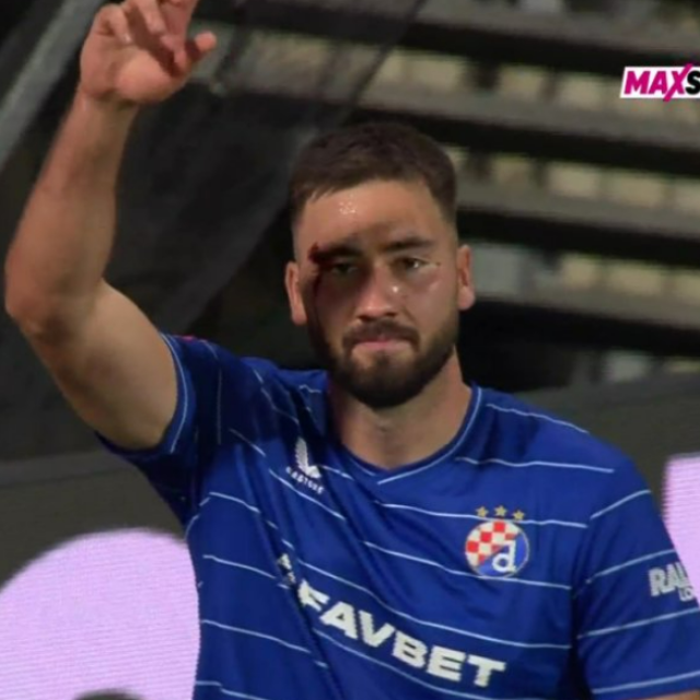 Belji suigrač rasjekao arkadu tijekom proslave pogotka