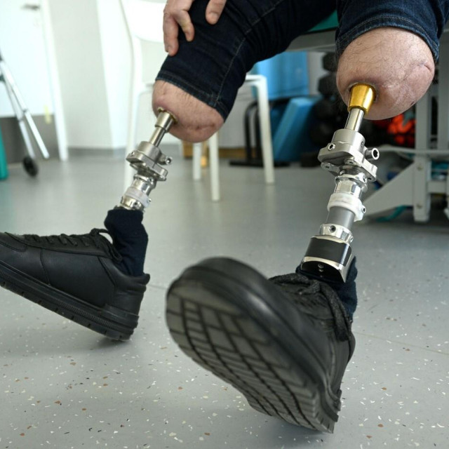 Teško ranjeni vojnik s protezama/Ilustracija