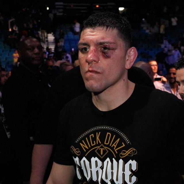 Nick Diaz