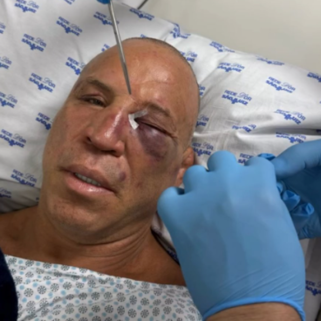 Wanderlei Silva nakon teškog nokauta