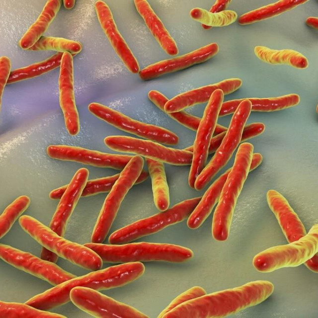 Ako se ne liječi, TBC može uzrokovati trajno oštećenje pluća ili se proširiti krvlju, što može dovesti do potencijalno smrtonosnih komplikacija, poput meningitisa ili zatajenja organa 