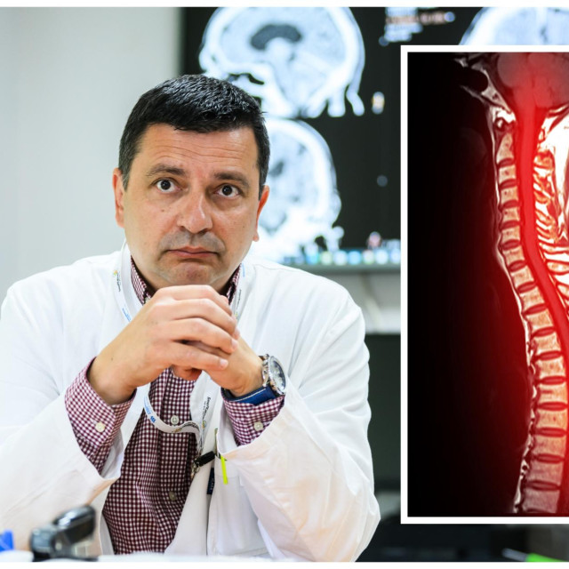 Dr. Vlatko Ledenko, neurokirurg, pročelnik Zavoda za neurokirurgiju splitskog KBC-a, u razgovoru koji donosimo u dva dijela govori o zdravstvenim problemima vezanim uz kralježnicu