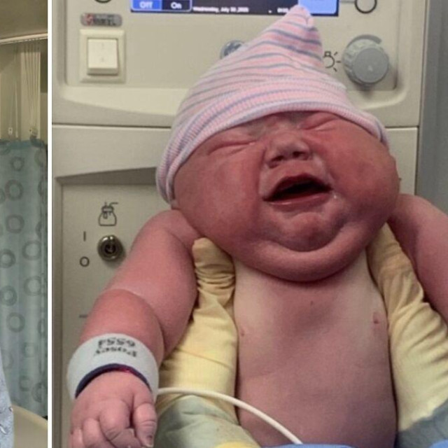 Priča o neobičnom porodu i bebi koja je sve ostavila bez riječi postala je viralna