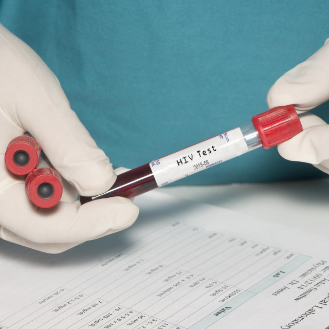 Testirate li se na HIV?