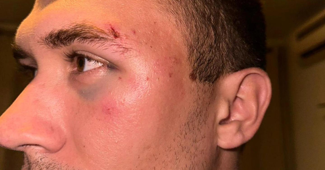 Po incidentu in napadu na igralce Metkovića se je oglasil klub: 'Sramotno in nedopustno vedenje, opravičujemo se'