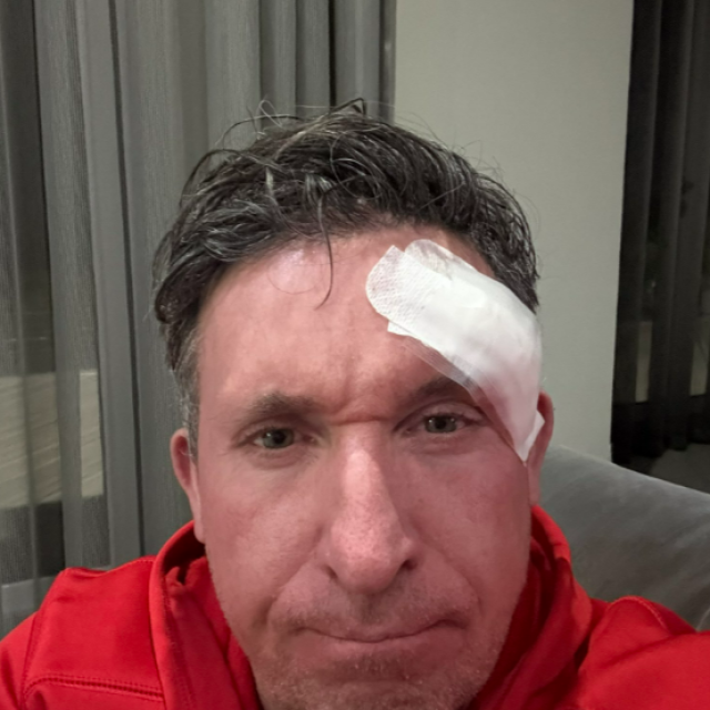 Robbie Fowler, karcinom kože na licu
