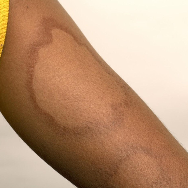 Ilustrativna fotografija