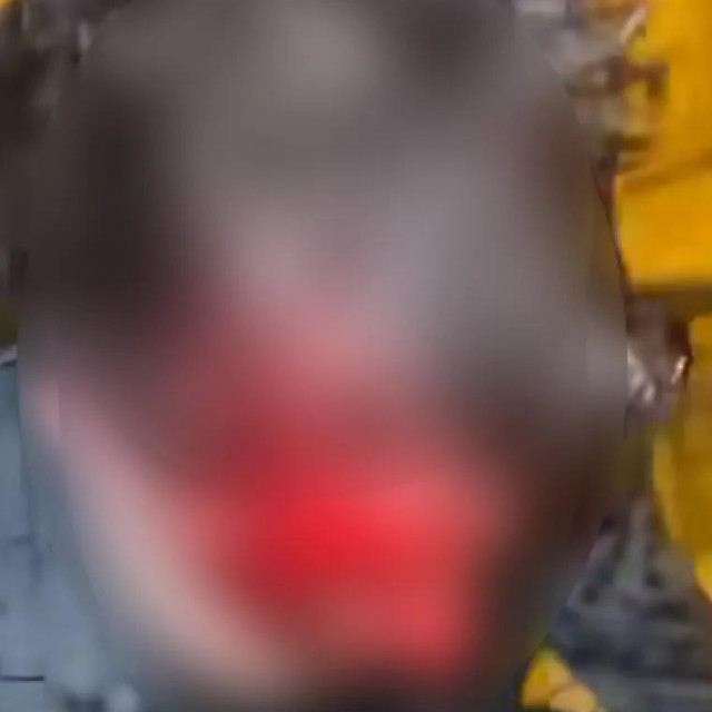 Druševenim mrežama širi se snimka pretučenog mladića