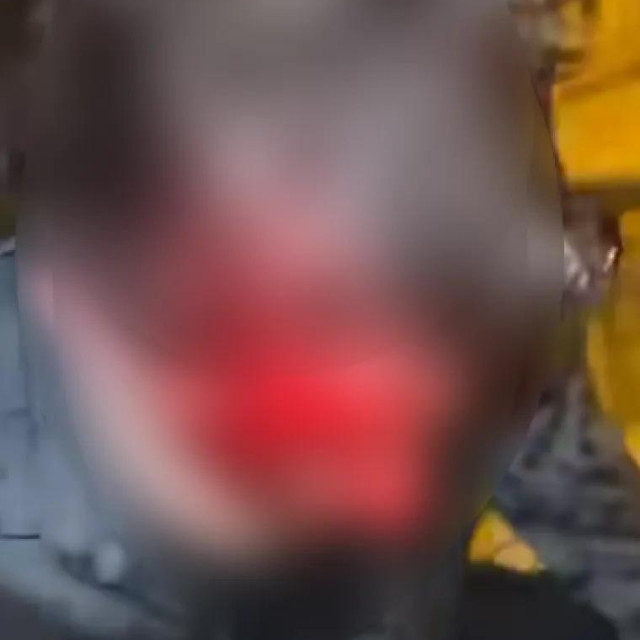 Druševenim mrežama širi se snimka pretučenog mladića