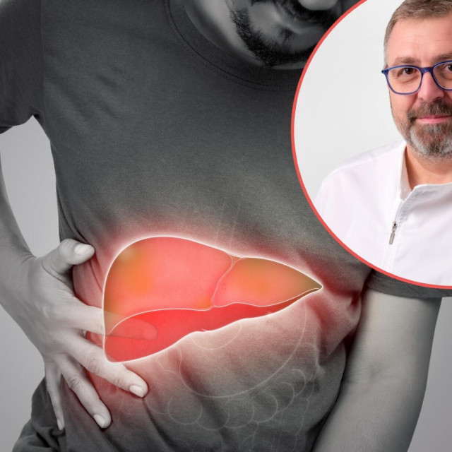 Masna jetra ne boli, ali može ubiti. Dr. Kristijan Podrug objašnjava zašto je ova dijagnoza daleko ozbiljnija nego što mislim