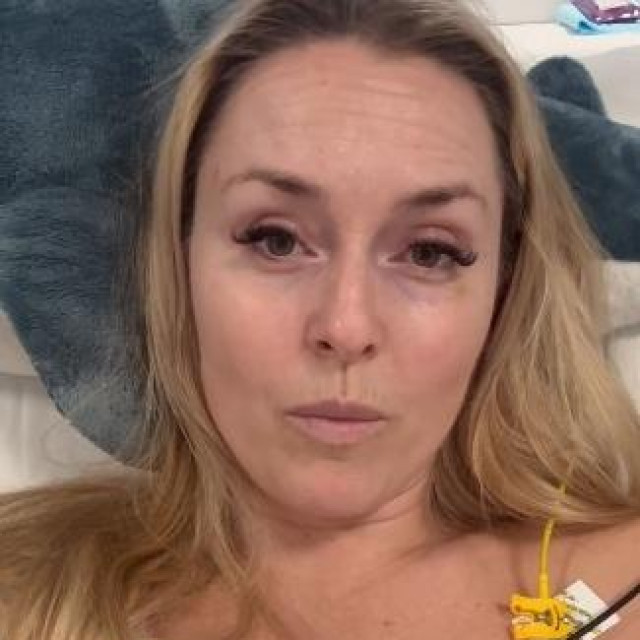 Lindsey Vonn trenutno je u fazi oporavka 