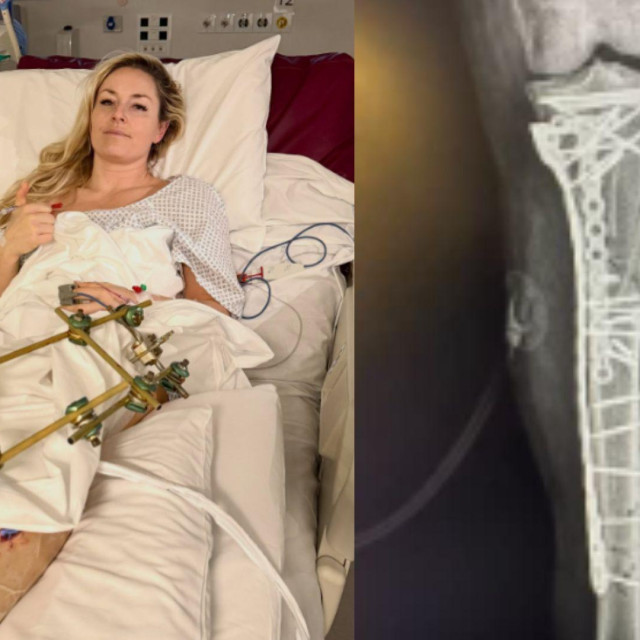 Lindsey Vonn u suzama otkrila potresne detalje