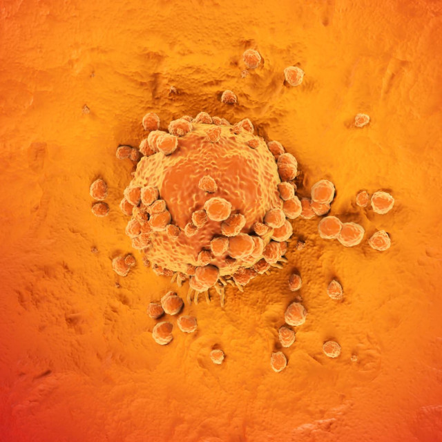 Stanica melanoma