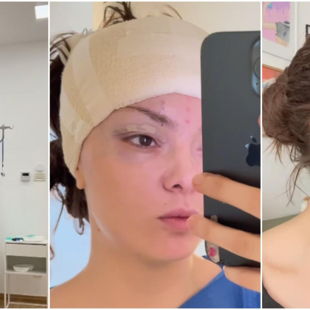 Ella Dvornik je podijelila svoje iskustvo na Instagramu