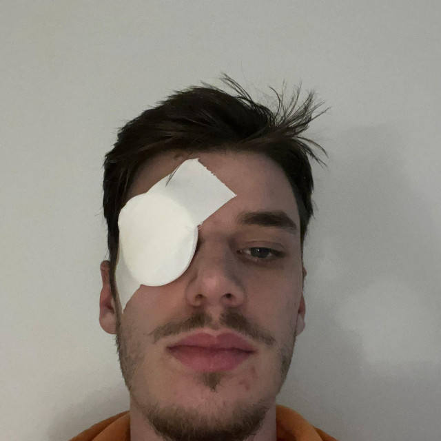 Vito Kučić ozljeda oka