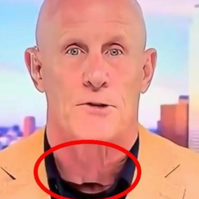 Robert Harward i bizaran detalj na njegovom vratu