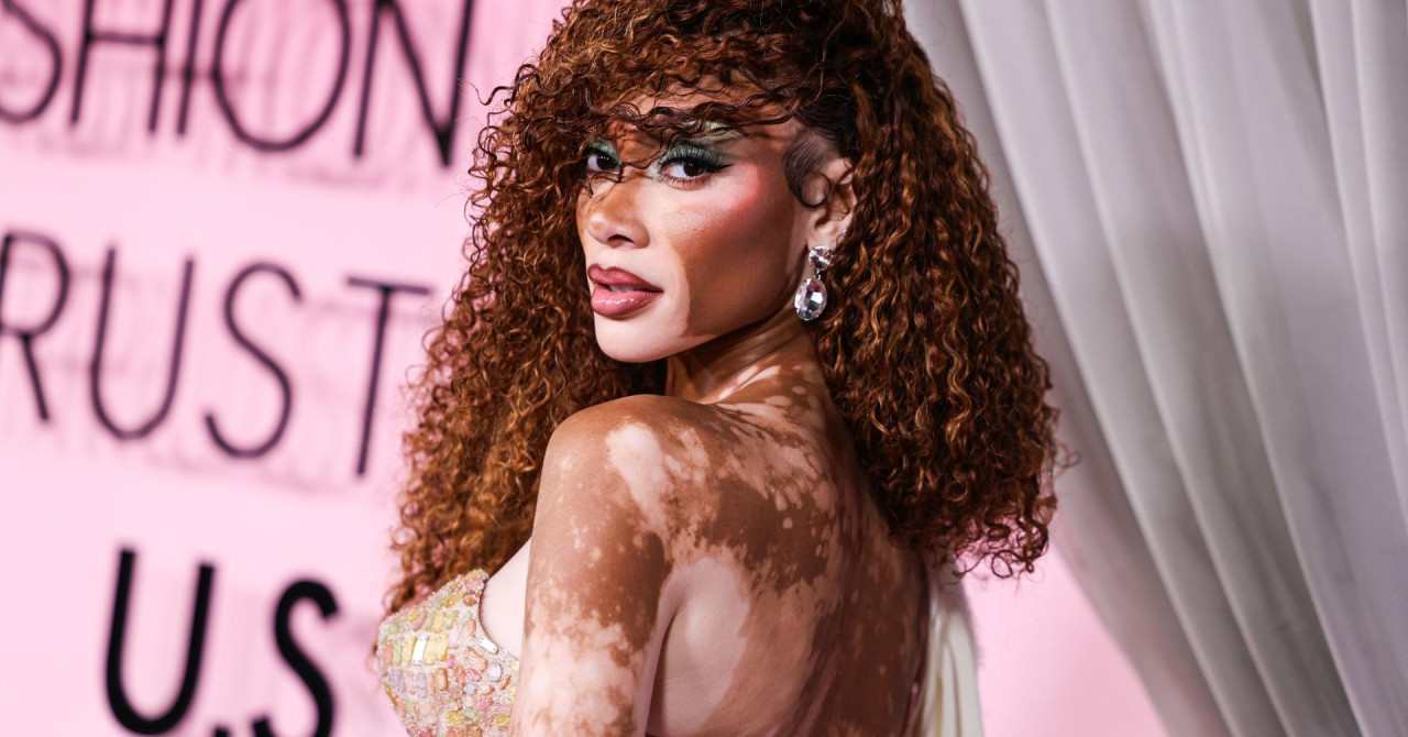 Slavna manekenka sa zaručnikom uživa u Dalmaciji: Winnie Harlow i NBA košarkaš snimljeni u Dubrovniku